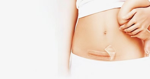 Warum sind dicke Silikongel-Narbentücher so beliebt?